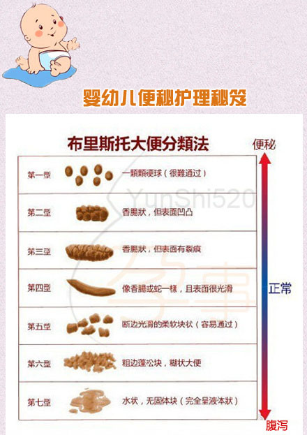 婴儿一个月大便秘怎么办？全面解析宝宝便秘问题及其解决方案