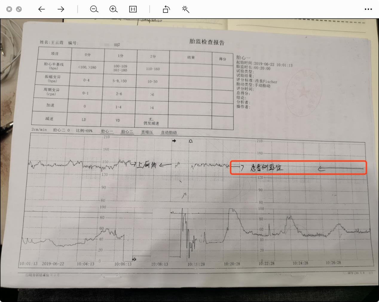 胎监几个月开始做，了解孕期监测的重要性与适宜时间