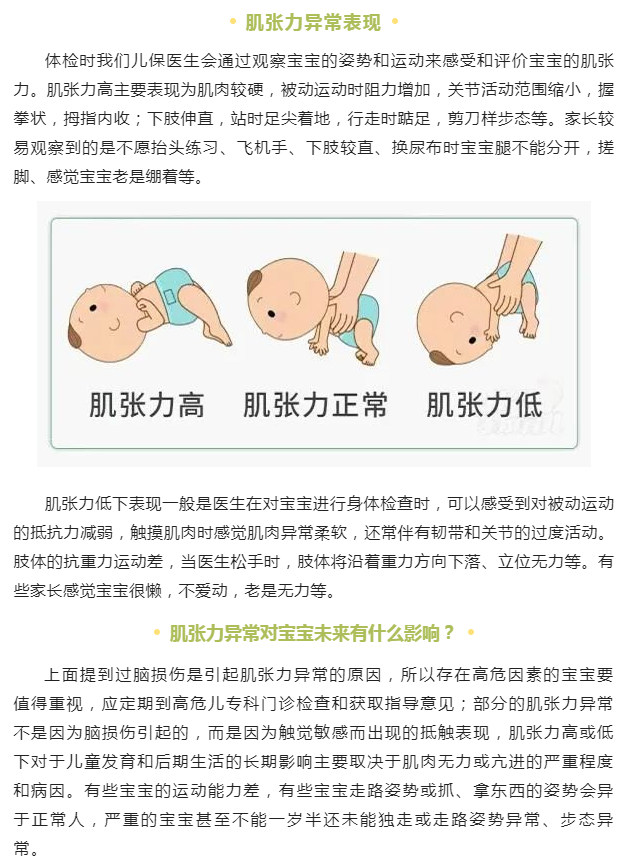 关于五个月宝宝肌张力高的研究